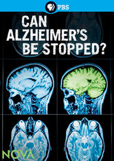 Netflix: Can Alzheimer;s Be Stopped? | <strong>Opis Netflix</strong><br> Choroba Alzheimera stanowi wielkie wyzwanie dla nauki. Pacjenci decydujÄ… siÄ™ poddaÄ‡ badaniom klinicznym, które mogÄ… pomóc w znalezieniu skutecznej terapii, a nawet leku. | Oglądaj film na Netflix.com