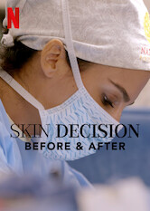 Kliknij by uszyskać więcej informacji | Netflix: We wÅ‚asnej skÃ³rze: Przed iÂ po | Specjalistka od medycyny estetycznej, siostra Jamie, iÂ chirurg plastyk, dr Sheila Nazarian, uÅ¼ywajÄ… najnowszych technologii, aby wydobyÄ‡ wewnÄ™trzne piÄ™kno klientÃ³w.