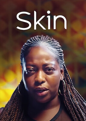 Netflix: Patch Adams | <strong>Opis Netflix</strong><br> Po opuszczeniu zakÅ‚adu psychiatrycznego pewien mÄ™Å¼czyzna postanawia zostaÄ‡ lekarzem iÂ poprawiaÄ‡ jakoÅ›Ä‡ Å¼ycia pacjentÃ³w, wprowadzajÄ…c ich wÂ dobry nastrÃ³j. | Oglądaj film na Netflix.com